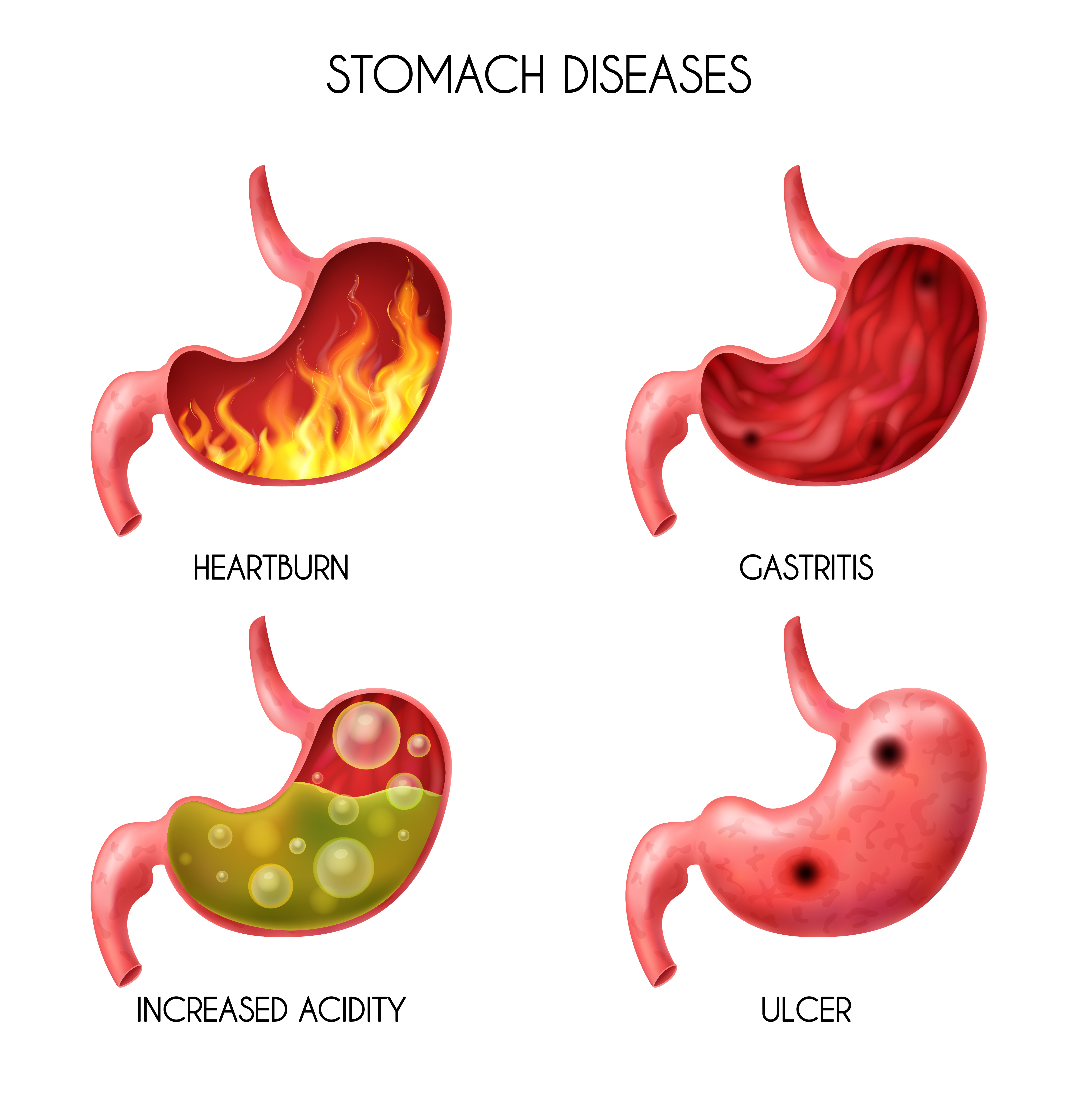 Best Hospital for Gall Bladder Best Hospital for Gall Bladder Surgeries in Mulund