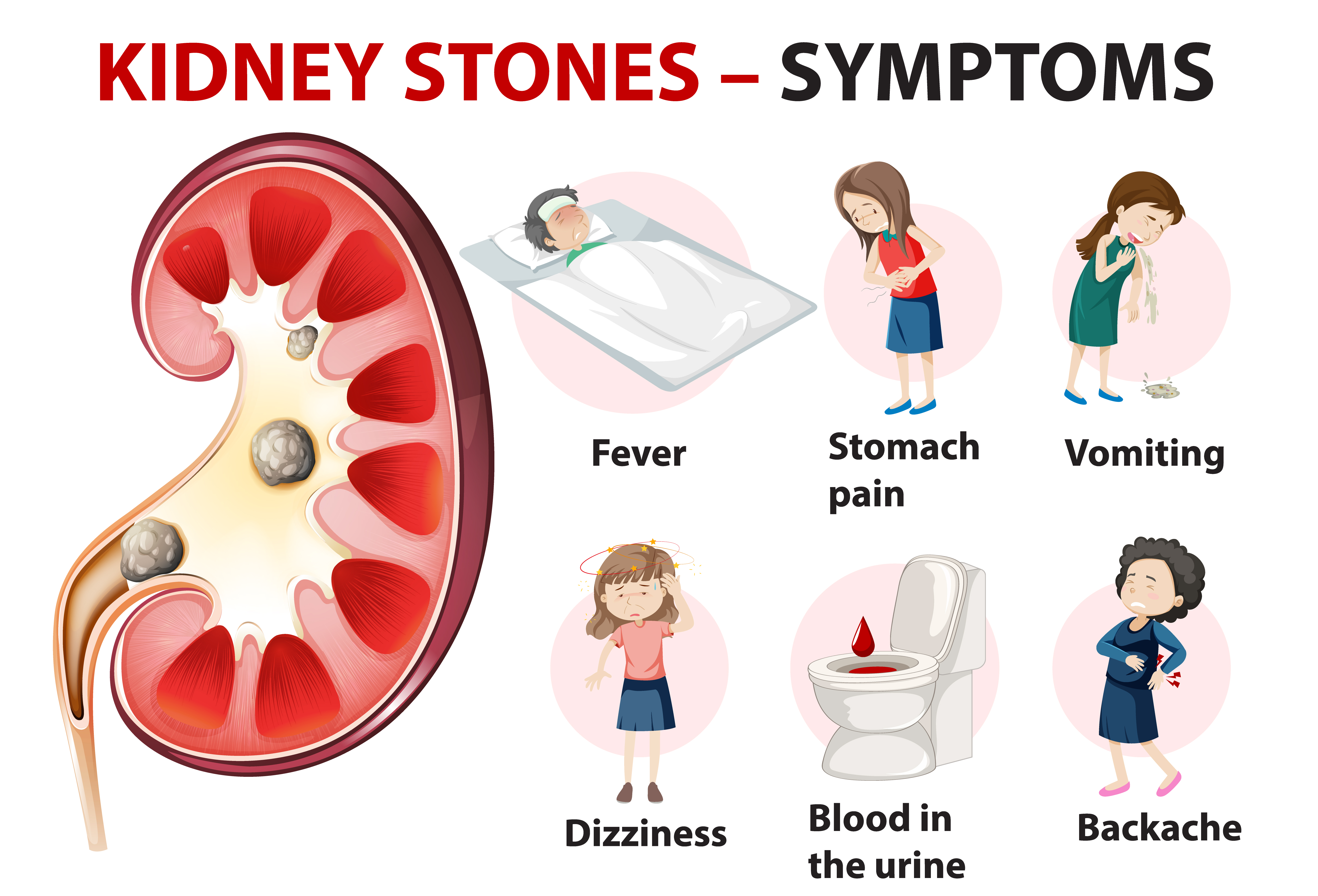 Best Hospital for Kidney Stone Best Hospital for Kidney Stone in Mulund