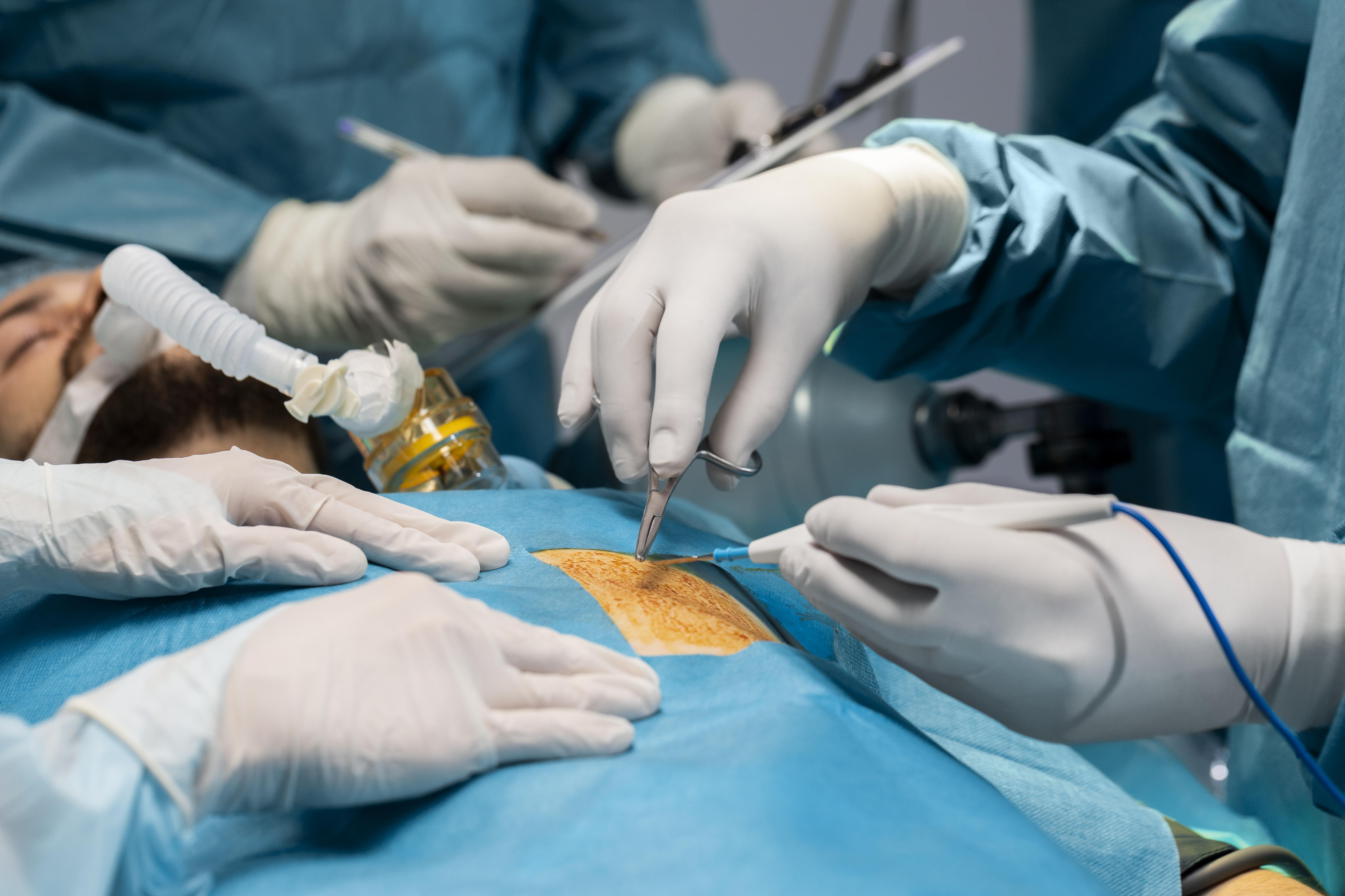 laparoscopic surgery laparoscopic surgery treatment in Mulund